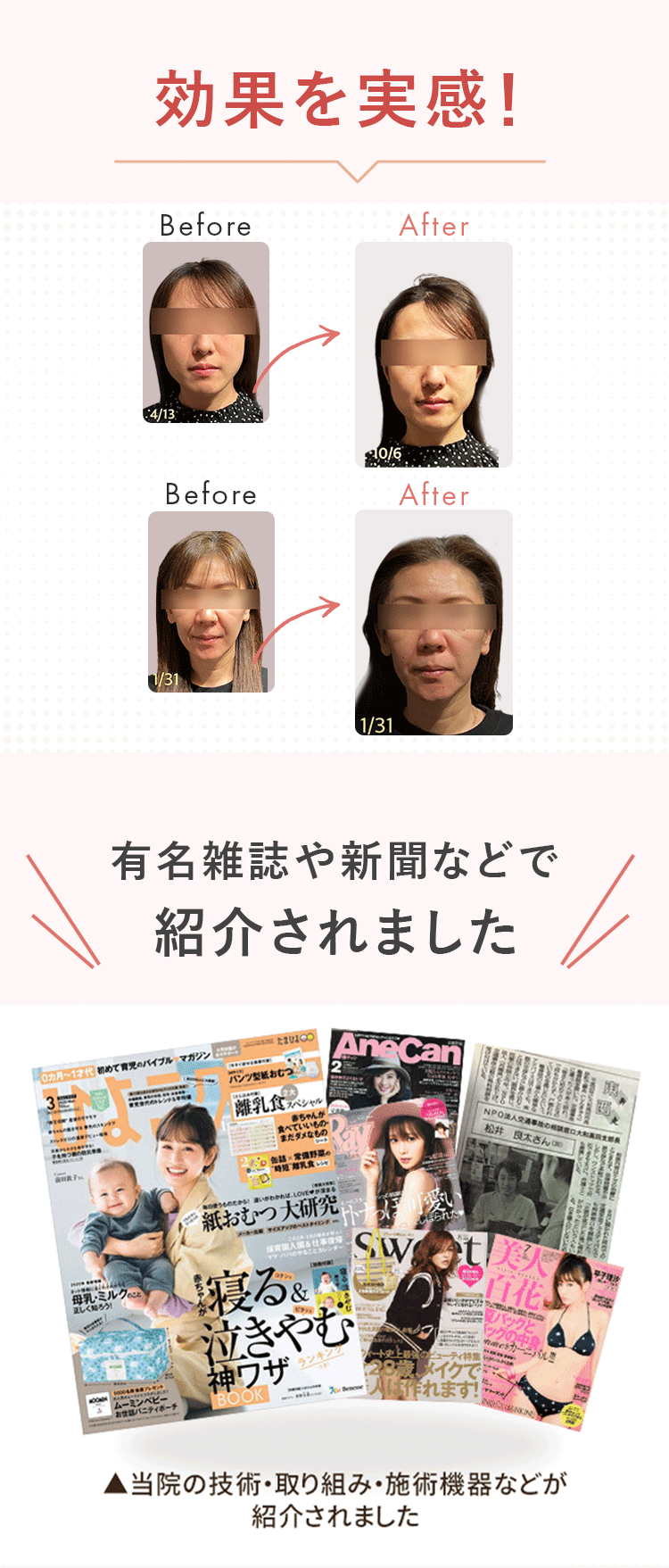ビフォアフター